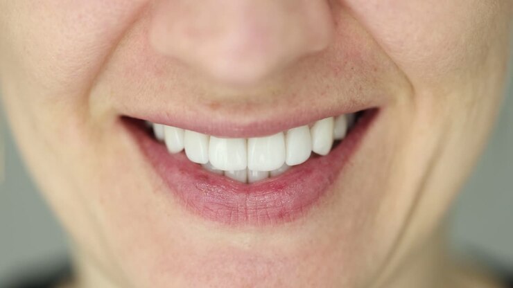 Primo piano di una persona che sorride e mostra i denti bianchi