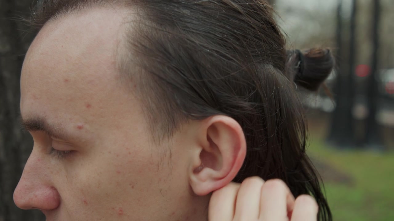 Primo piano di un giovane uomo con texture della pelle e attaccatura dei capelli visibili, mentre un altro uomo gli tocca delicatamente la testa. La scena è all'aperto con luce naturale, focalizzata sull'interazione tra i soggetti.