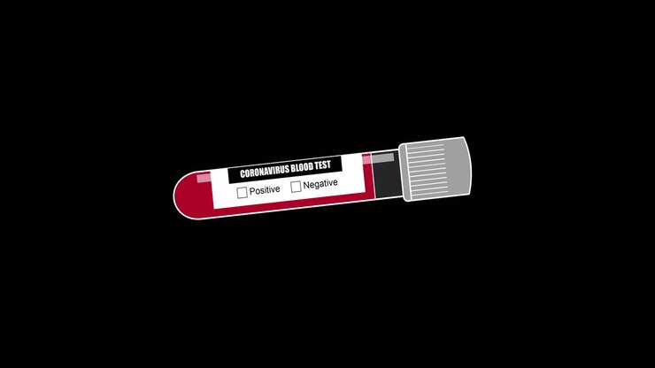 Positive Test Of Coronavirus Covid 19 Animation