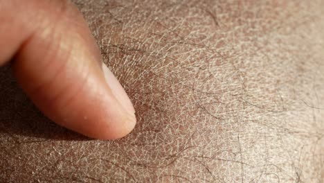 close-up of dry skin on a person's arm