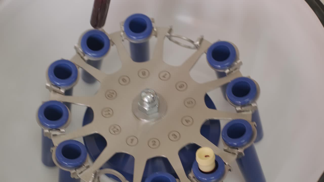 혈소판이 풍부한 플라즈마 준비: 손에 혈액을 가진 튜브, 원심분리기, 배경