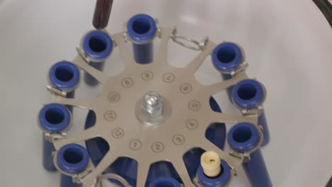 preparación de plasma rico en plaquetas. tubo con sangre en las manos. centrifugadora.