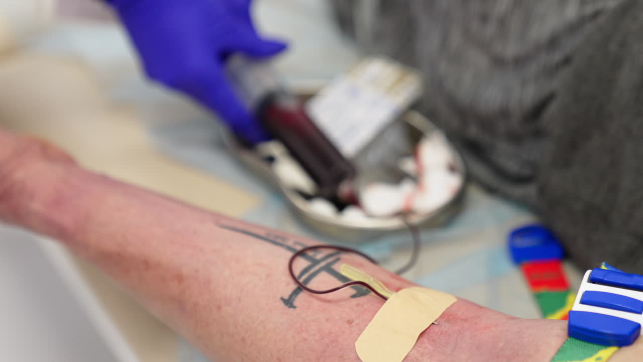 Catheter and adhesive plaster attached to the tattooed male hand. Close up. A large syringe is filled with blood.