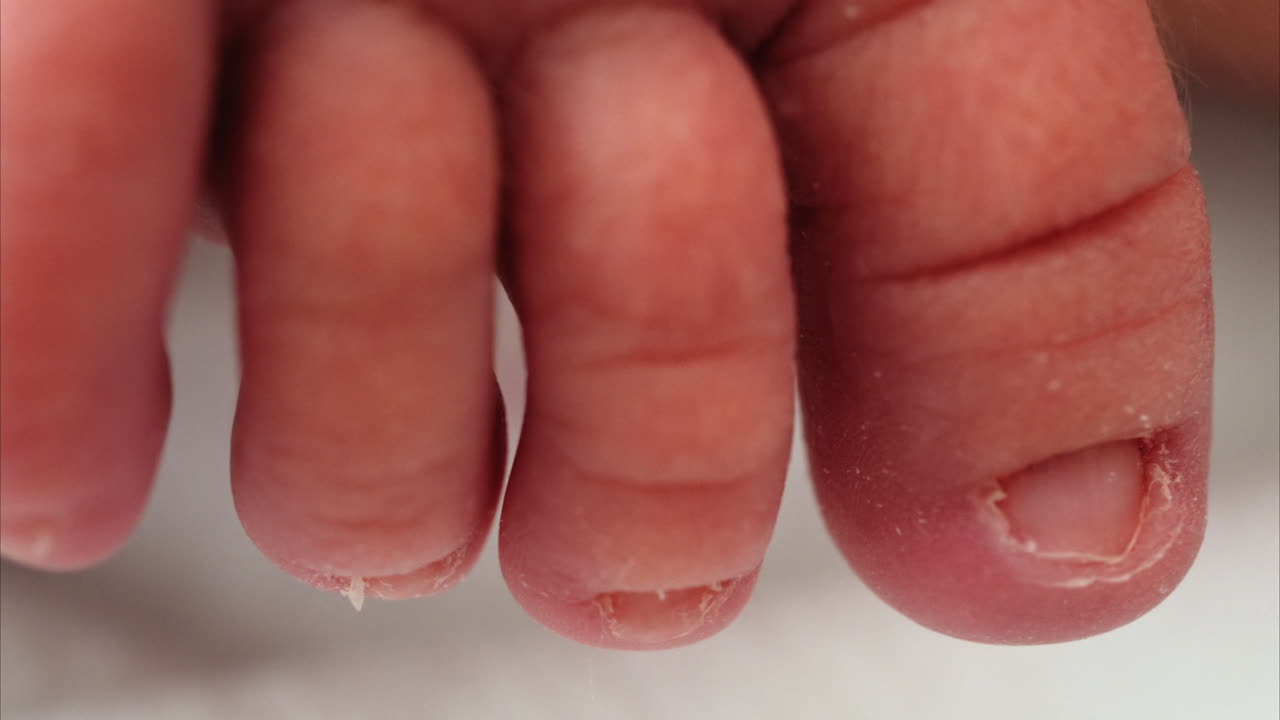 Close up of a the toes of a newborn baby resting on a white bedding with different patterns