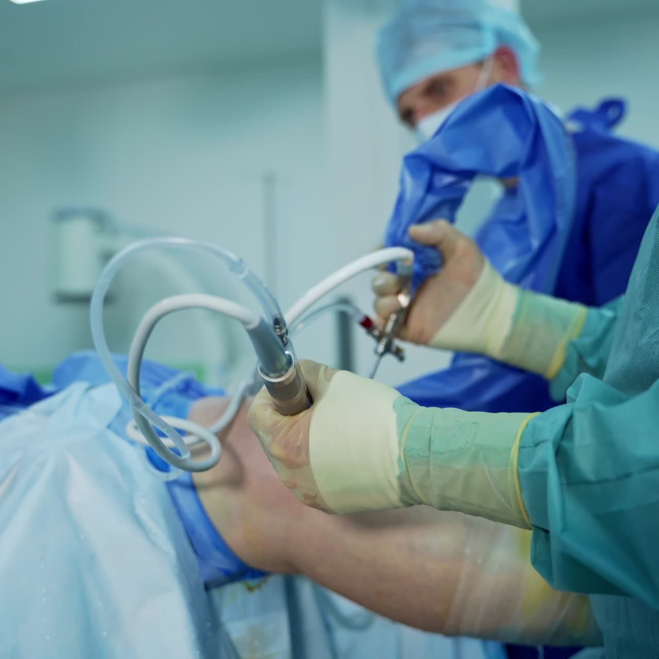 Process of trauma surgery operation. Group of surgeons in operating room with surgery equipment