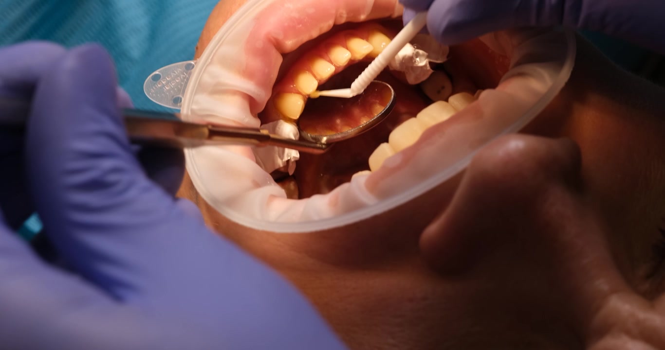 Dentista con guanti protettivi esamina i denti del paziente