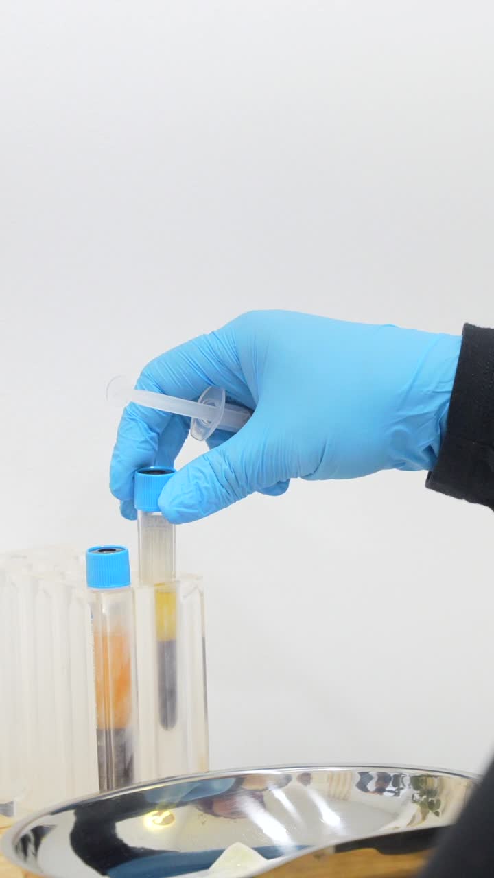 Medical procedure with blood tests