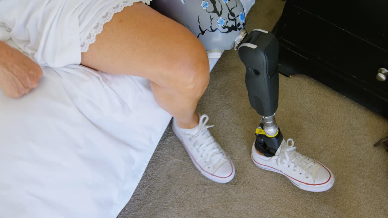 Woman with prosthetic leg tying her shoe laces 4k