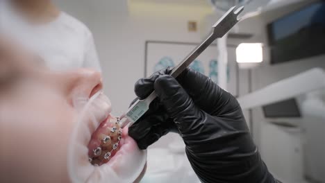 close up of dentist hand using dental forceps while putting orthodontic braces on female patient teeth. woman having dental procedure in clinic. concept of dentistry and orthodontic treatment.