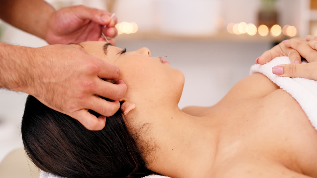 acupuntura facial, salud y mujer en el spa