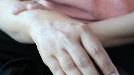 woman applying lotion to her arm