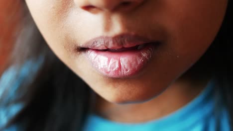 close-up of a child's chapped lips