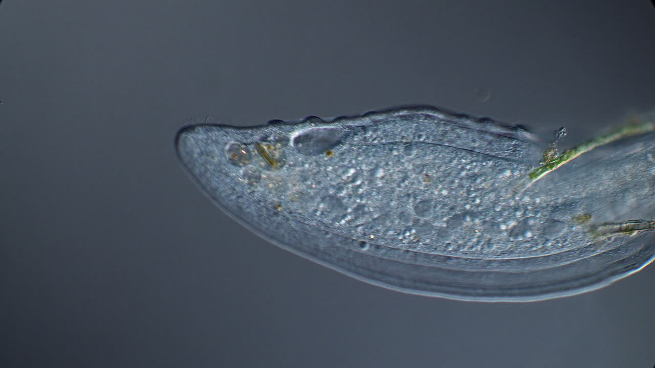 Microscopic View of a Ciliate Organism