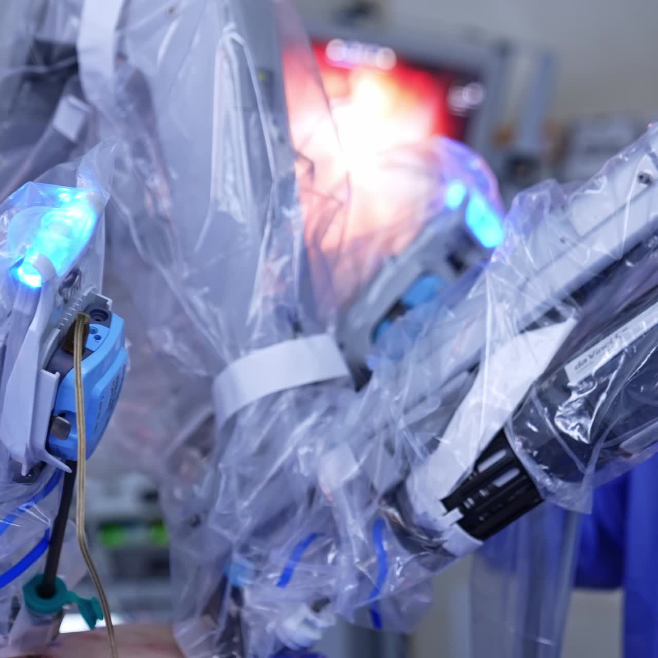 Robotic arms covered with plastic move being input into minimal cuts in patient's abdomen. Close up. Doctor at backdrop