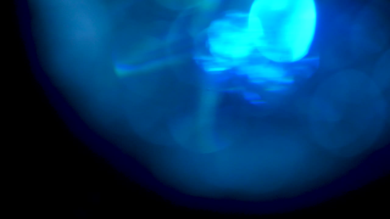 Abstract Blue Bokeh Backgrounds