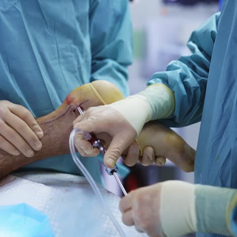 surgery on patient's leg. doctors in medical uniform conduct an operation using surgical instruments. close-up