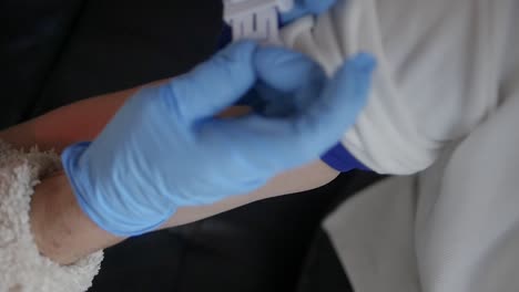una enfermera aplica un torniquete en el brazo de un paciente y golpea la vena antes de tomar una muestra de sangre