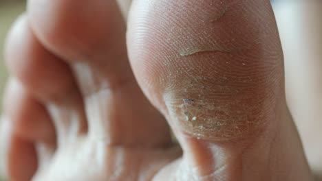 close up of young men dry feet on bed