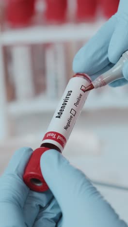 holding a blood test tube labeled adenovirus in a modern healthcare facility