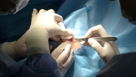 blepharoplasty plastic surgery operation. rejuvenation, modification the eye region