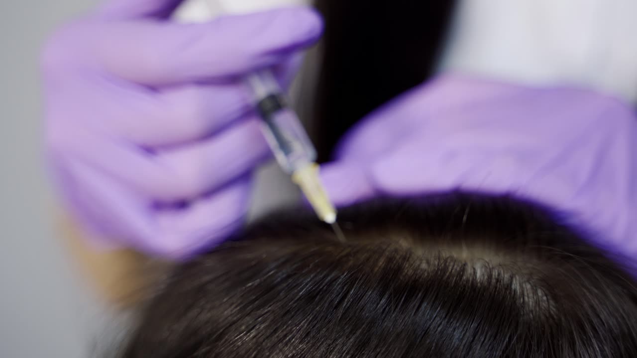 Young woman with hair problem receiving injection in clinic, close up