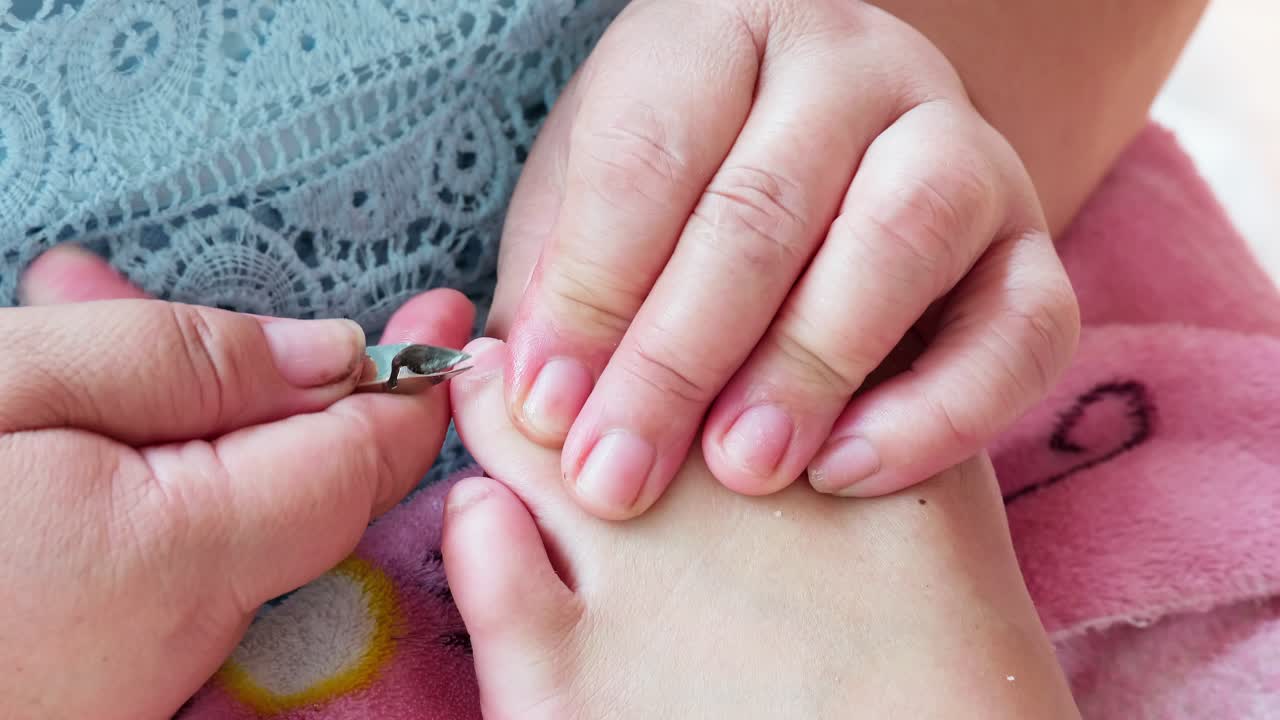 손톱깎이 기구를 이용한 전문 의료 페디큐어 시술-4