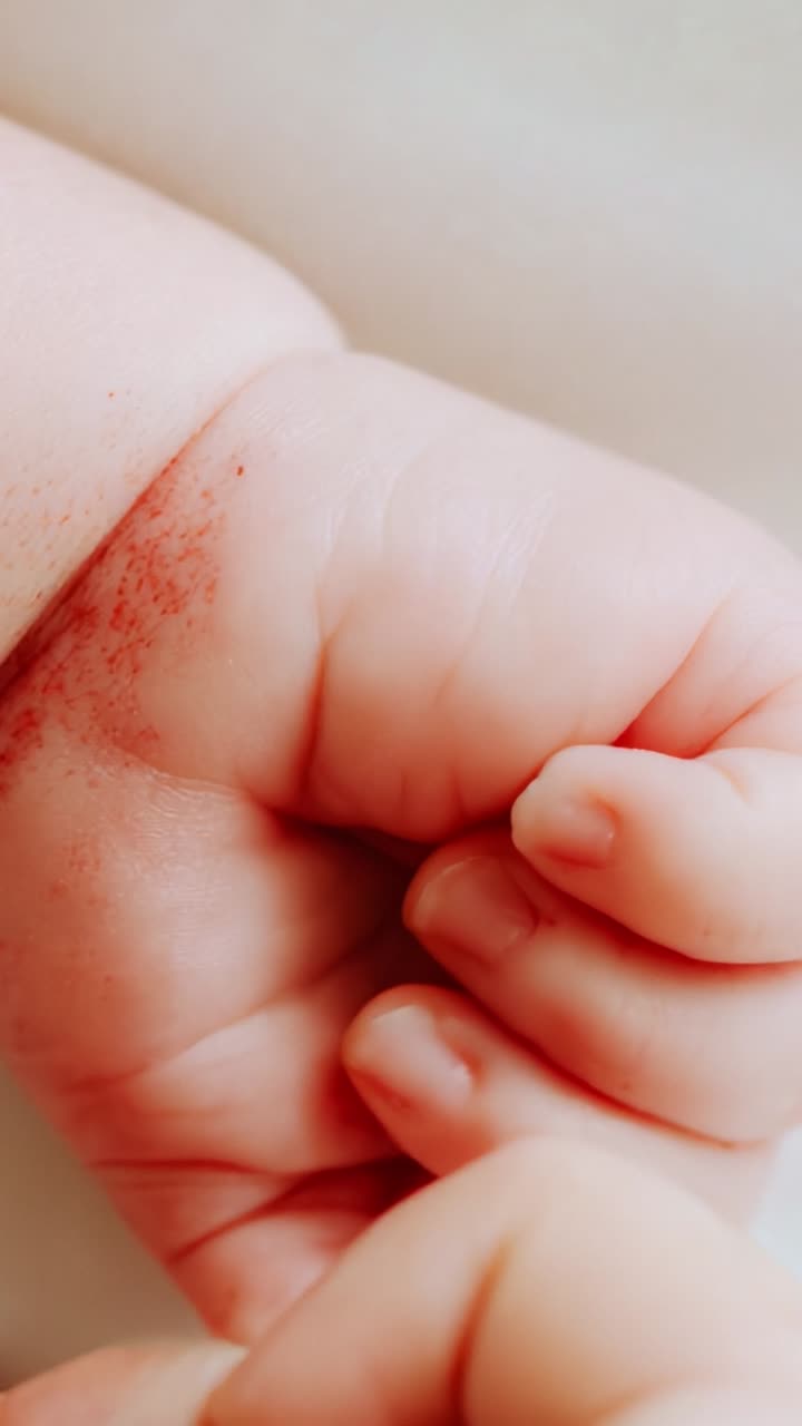 Close-Up of Infant's Hand with Small Marks on Skin, Capturing Tenderness and Innocence in Two Frames of Growth and Exploration in Early Childhood