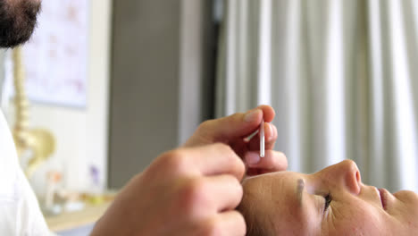 physiotherapist giving acupuncture treatment to female patient