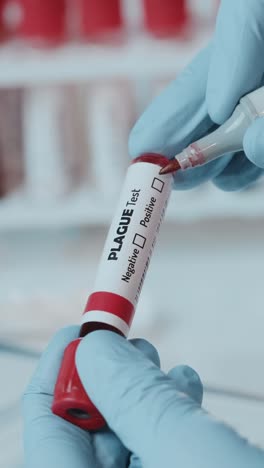 healthcare professional examines blood test tube labeled plague in lab setting