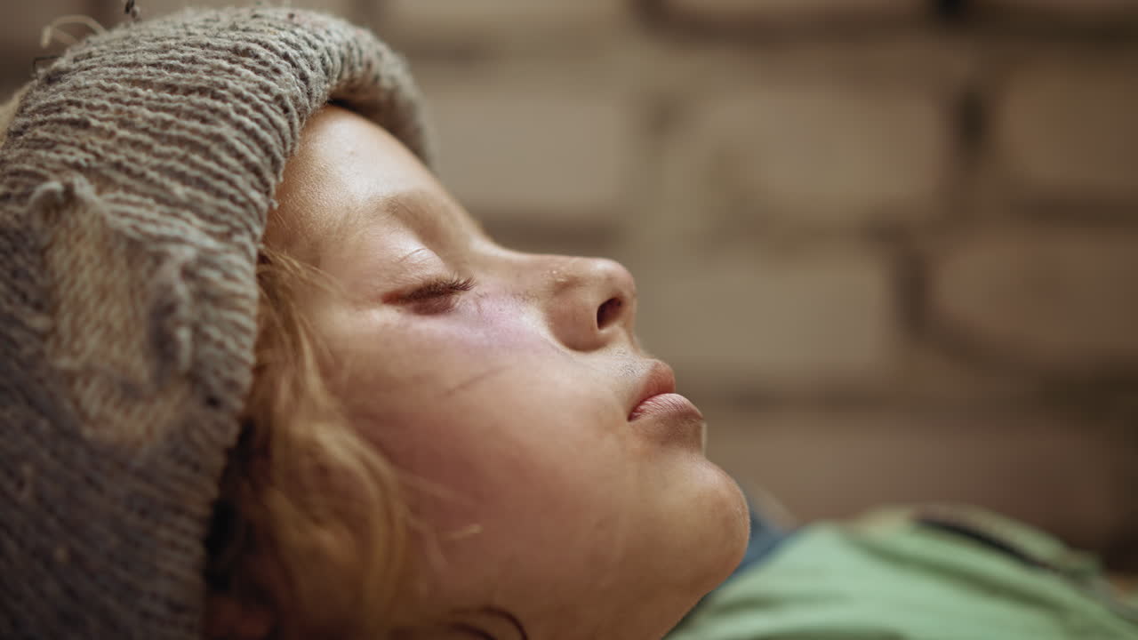 Extreme close up of displaced child lying still with eyes nearly closed, bruised cheekbone and pale skin visible under torn wool hat, soft side lighting highlighting sadness