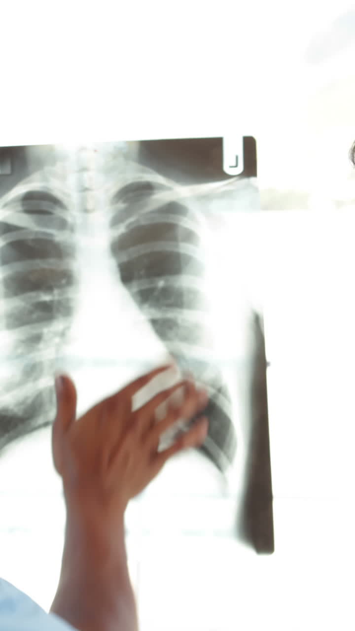 cirujano y médico mirando las radiografías juntos