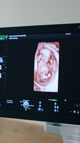 black monitor with unborn baby image on. ultrasound equipment for diagnostics of pregnancy. vertical video