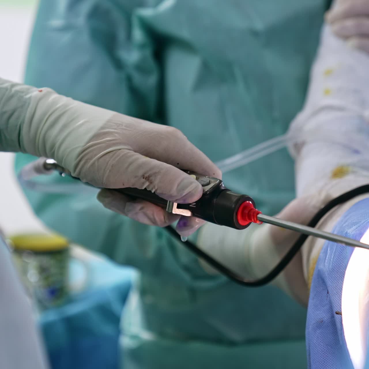 Gloved hand of a surgeon holding a device and using it at operation. Close up. Assisting medic holding a patient's hand at backdrop