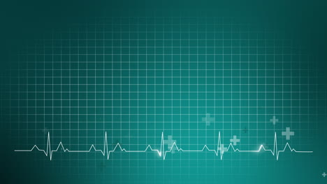 ecg graphic