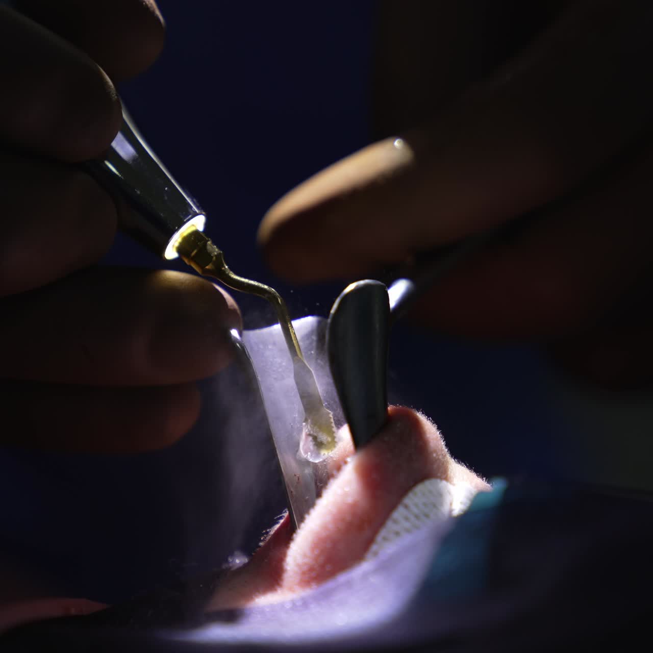 Macro operating with tools. Surgical operation in hospital