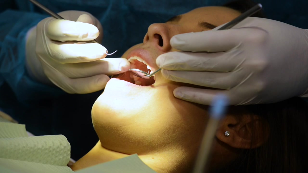 Vista ravvicinata di un trattamento dentale su un paziente