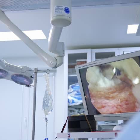 laparoscope instrument with video monitor