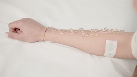 woman's arm with gel applied, preparing for a laser hair removal treatment at a clinic