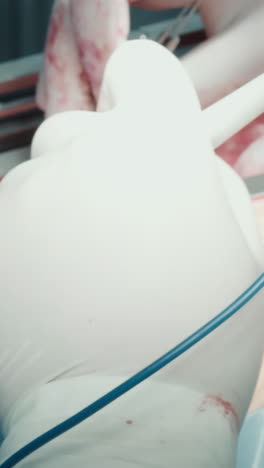 el médico con lentes de ampliación especiales se centra en la operación cardíaca con láser. el cirujano utiliza el bisturí con precisión exacta durante la cirugía de derivación de la arteria coronaria para garantizar el bienestar del paciente