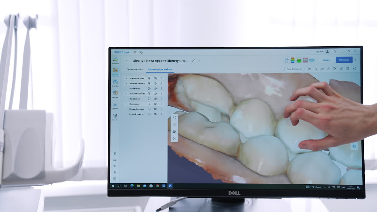 Dental 3D Modeling and Scanning Process