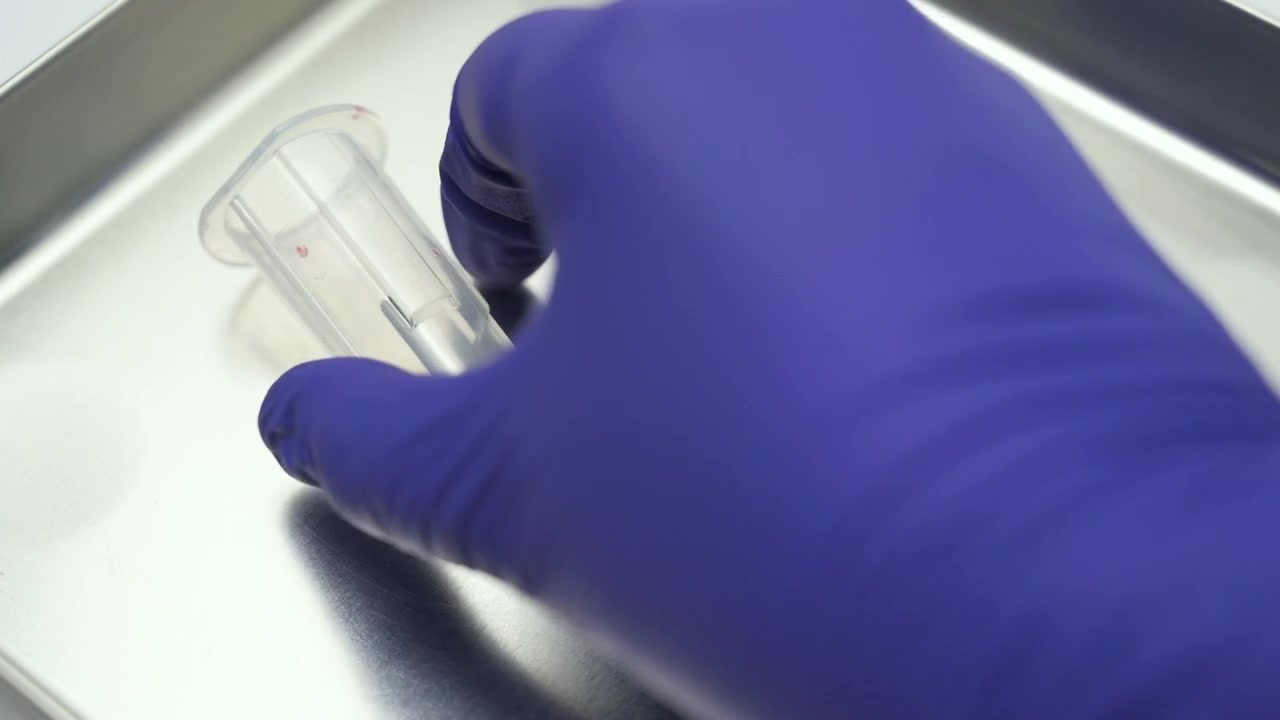 Medical personnel disposing of a used butterfly needle after drawing blood from a patient