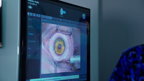 computer image of an eye during laser correction. ophthalmic clinic, surgery