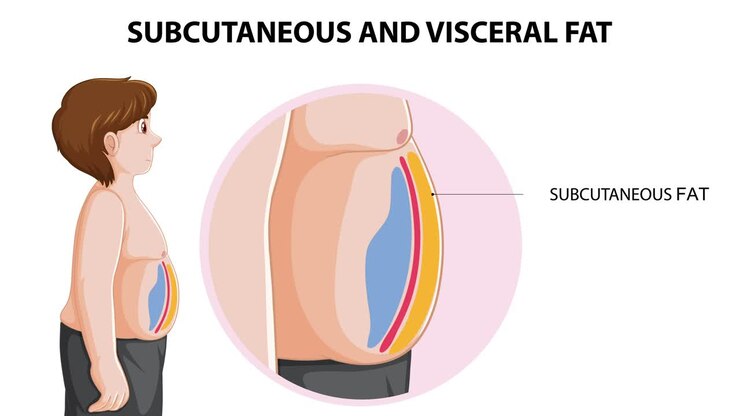 Animated depiction of subcutaneous and visceral fat layers