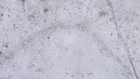 freshly hatched germinated slime mold spores to amoeba between other spores