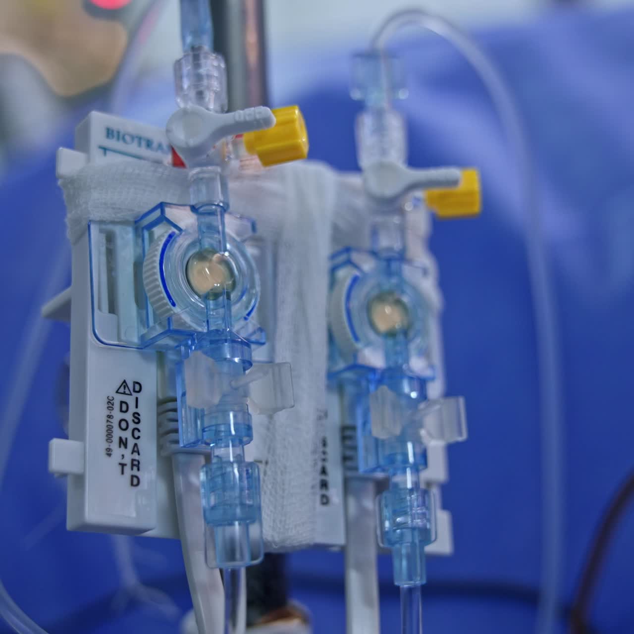Attrezzatura medica con numerosi cavi collegati. Contagocce in sala operatoria. Primo piano. Sfondo sfocato