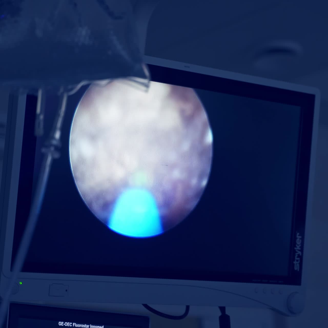 Monitoring of patient during operation. Medical team performing surgical operation in modern operating room