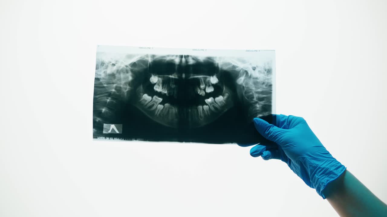 Hand in Blue Glove Holding Dental X-ray Film