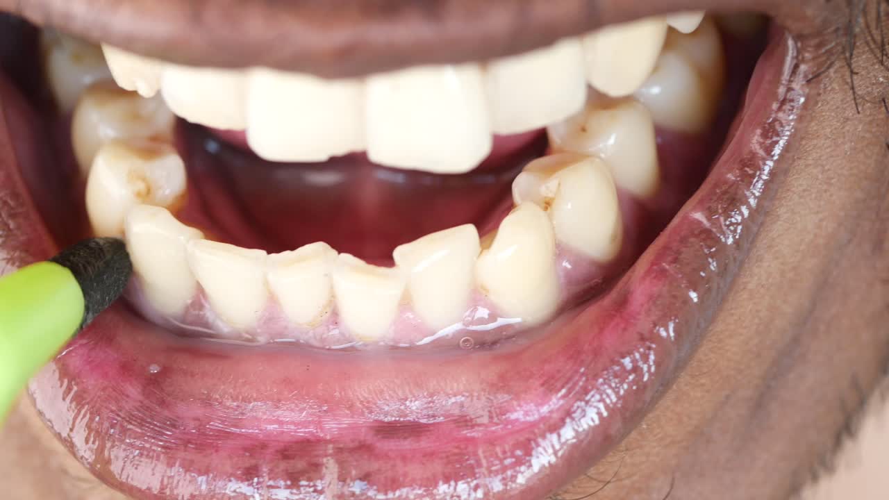 Dental Issues Close-up