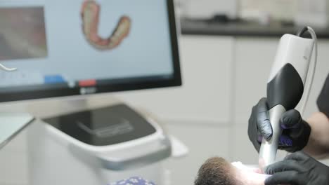 doctor scans the patient's teeth in the clinic. the dentist holds in his hand a manual 3d scanner for the jaw and mouth. dental health. creates a 3d model of teeth and gums on a medical monitor.