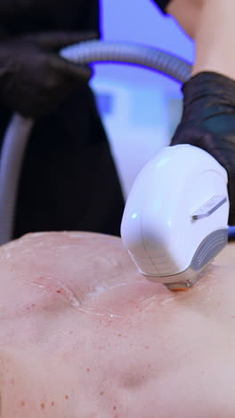 laser epilator is moved by the male chest covered with gel. man's eyes are protected with goggles. vertical video